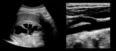 Clinical applications of ultrasound imaging & Doppler for clinicians new to it.