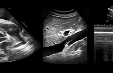 Banner showing POCUS ultrasound images.