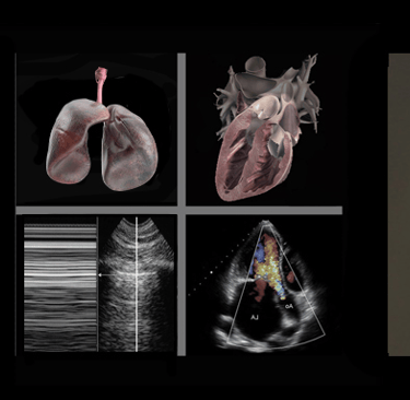 Ultrasound images of the lungs and heart with reflections of same in eyeglasses.