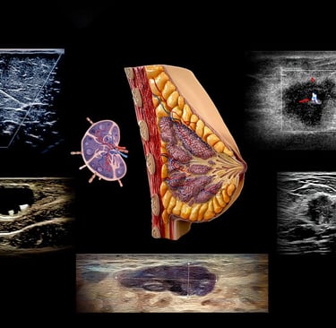Montage of breast ultrasound images showing normal findings, breast cancer, and breast biopsy technique.