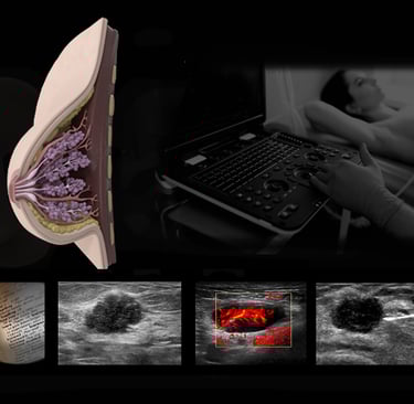 Breast ultrasound images.