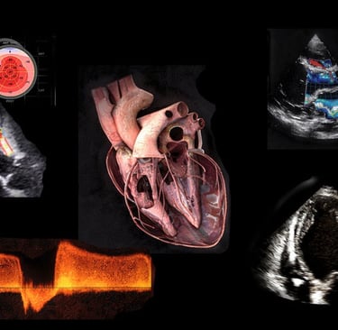 Montage of ultrasound images showing the heart and echocardiography findings.