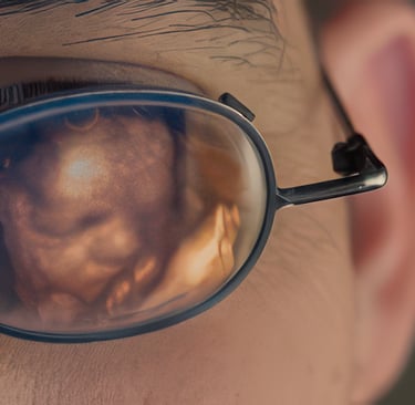 Eyeglasses showing the  reflection of a 3-D image of fetal ultrasound in our training course.