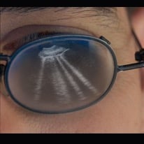 Eyeglasses showing the  reflection of an image of lung ultrasound in our hands-on training course.