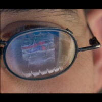 Reflection of vascular duplex Doppler in eyeglasses.