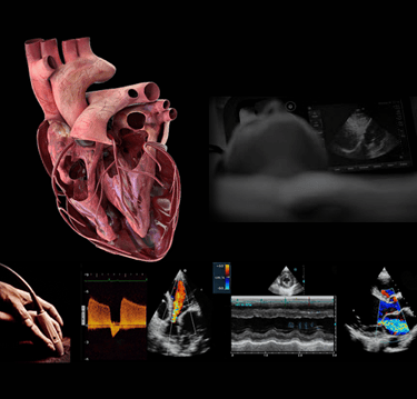 Panel of anatomy and hands-on echocardiographic cardiac ultrasound images. 