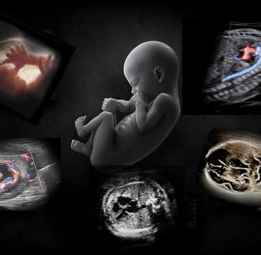 Montage of OB ultrasound images showing the findings in early, mid, and late-term pregnancy.