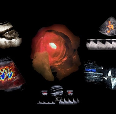 Montage of ultrasound images showing vascular disease inside the human arterial and venous systems.