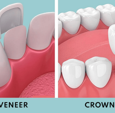 Cosmedic Express Dental Implant Experts
