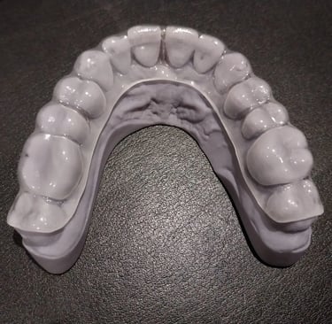 Dual Laminated Mouthguards