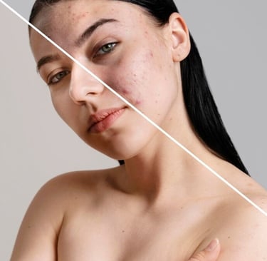 portrait-photo-retouching-blemish-and-scar-removal