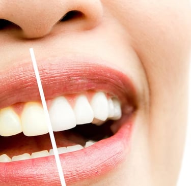portrait-photo-retouching-teeth-whitening