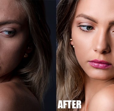 Skin Refinement