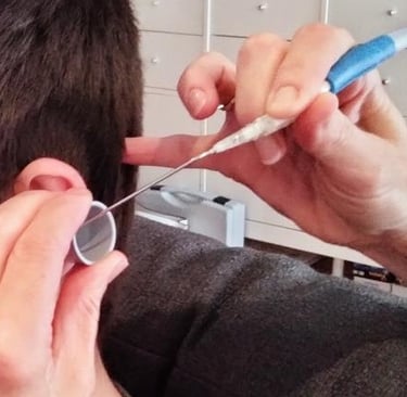 A client having ear wax removal with microsuction