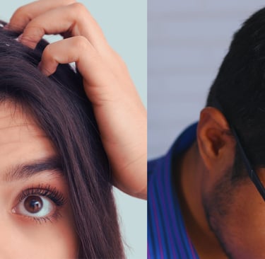 man and woman with dandruff