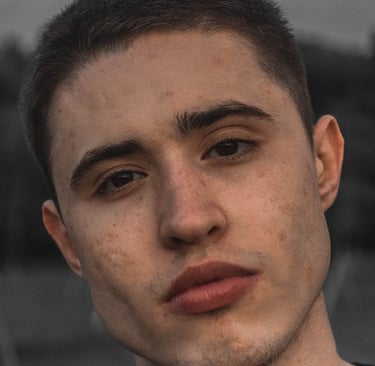 acné