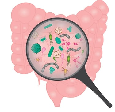 SIBO bacterial overgrowth