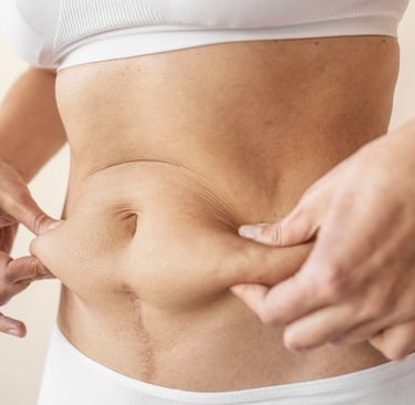 cirurgia bariátrica e reparadora