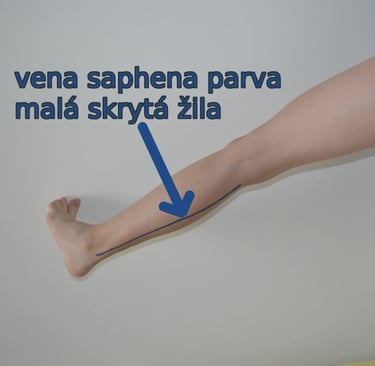 a person with a blue arrow pointing to the left side of the arm