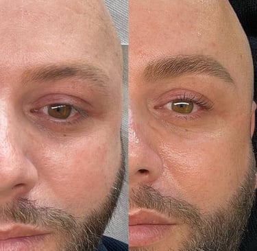 Résultat avant-après d'une restructuration sourcils 