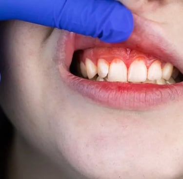 bleeding gums while brushing in kids