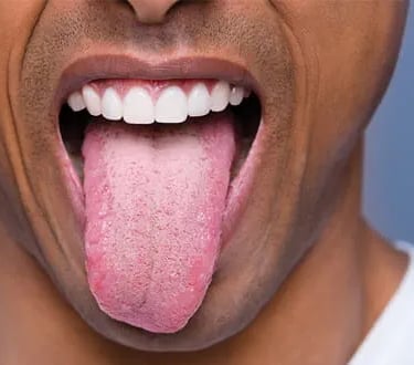 a image showing tongue