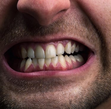 a image showing man clenching his teeth