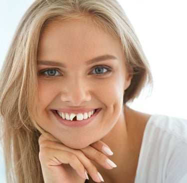 a woman smiling with a broken tooth