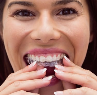 a person wearing clear aligner depicting advantages of using clear aligners
