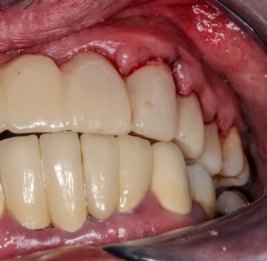 an image showing swollen gums