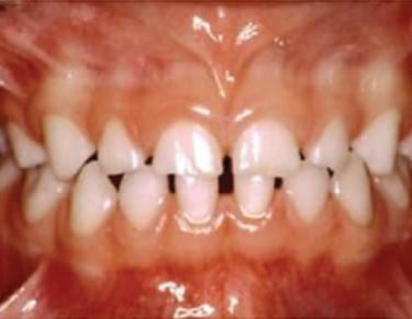 a image showing all teeth in mouth