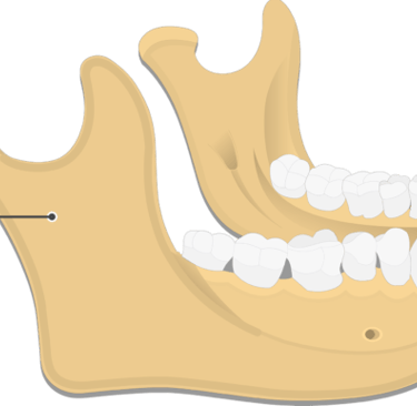 an image showing ramus of mandible