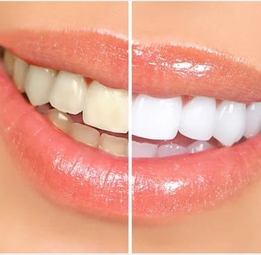 an image showing stained and whitened teeth 