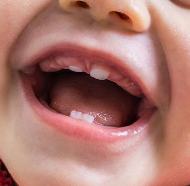 a baby mouth with four teeth in teething phase