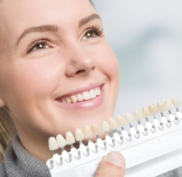 Selecting teeth colour for teeth whitening