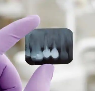 a person holding dental x-ray in hand
