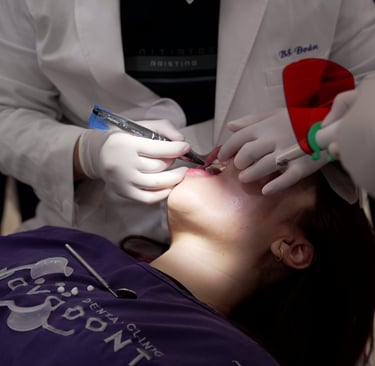 Painless Wisdom Tooth Removal Treatment in Pune