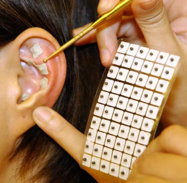 l'auriculothérapie, médecine douce sans acupuncture pour améliorer la santé, médecine douce