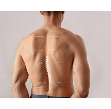 colonna vertebrale su un paziente