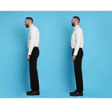 postura ipercifotica