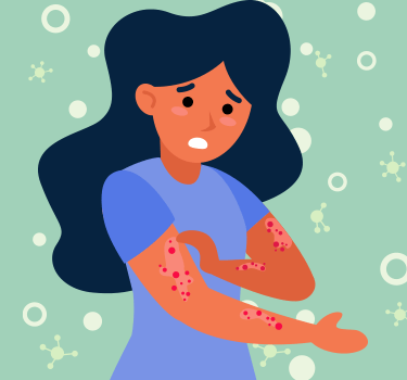 lady with skin rash/eczema