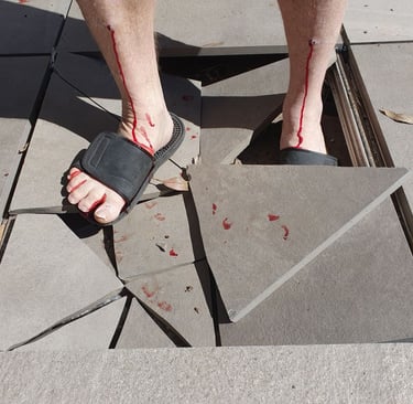 Injury caused by pedestal tile breaking