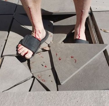 Injury caused by pedestal tile breaking
