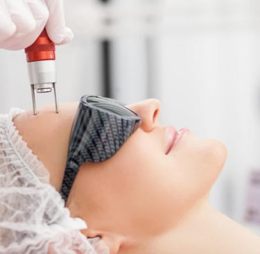 woman receiving laser skin resurfacing treatment