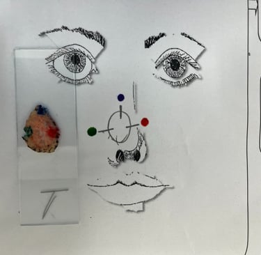Preparo peça e confecção mapa, Cirurgia Micrográfica de Mohs em Salvador, Bahia