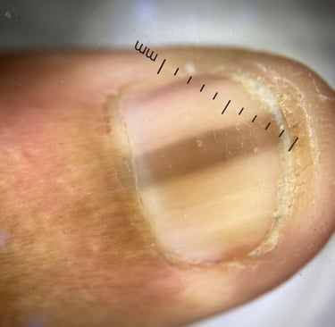 Melanoníquia, Salvador/Bahia