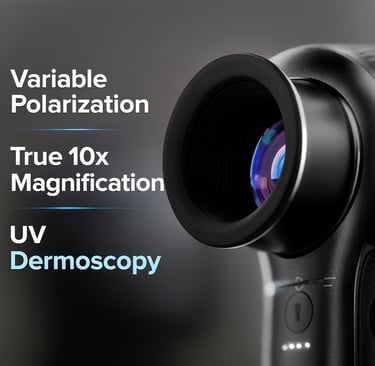 Dermlite DL5 Dermatoscope