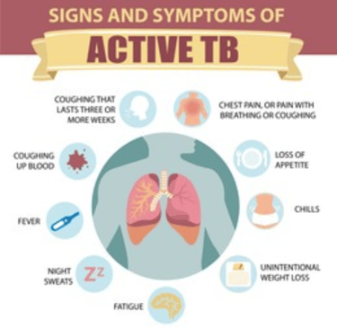 signs-and-symptoms-of-active-TB