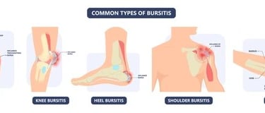 borsitis