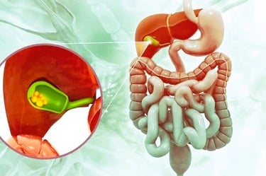 gallstones